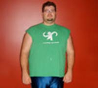 Before Weight Loss Photo