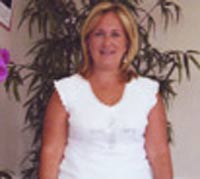 Before Weight Loss Photo