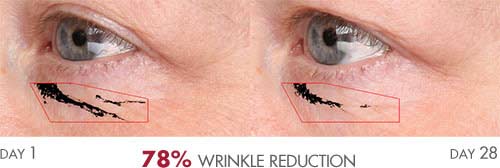 Anti-Aging Serum results