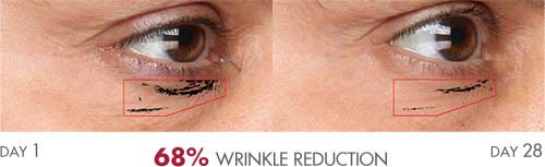 Anti-Aging Serum results