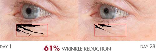 Anti-Aging Serum results