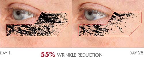 Anti-Aging Serum results