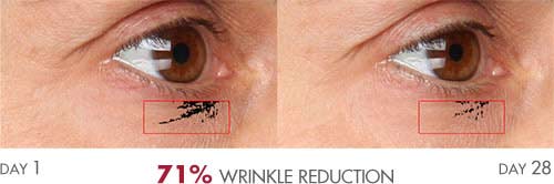 Anti-Aging Serum results