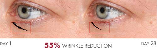 Anti-Aging Serum results